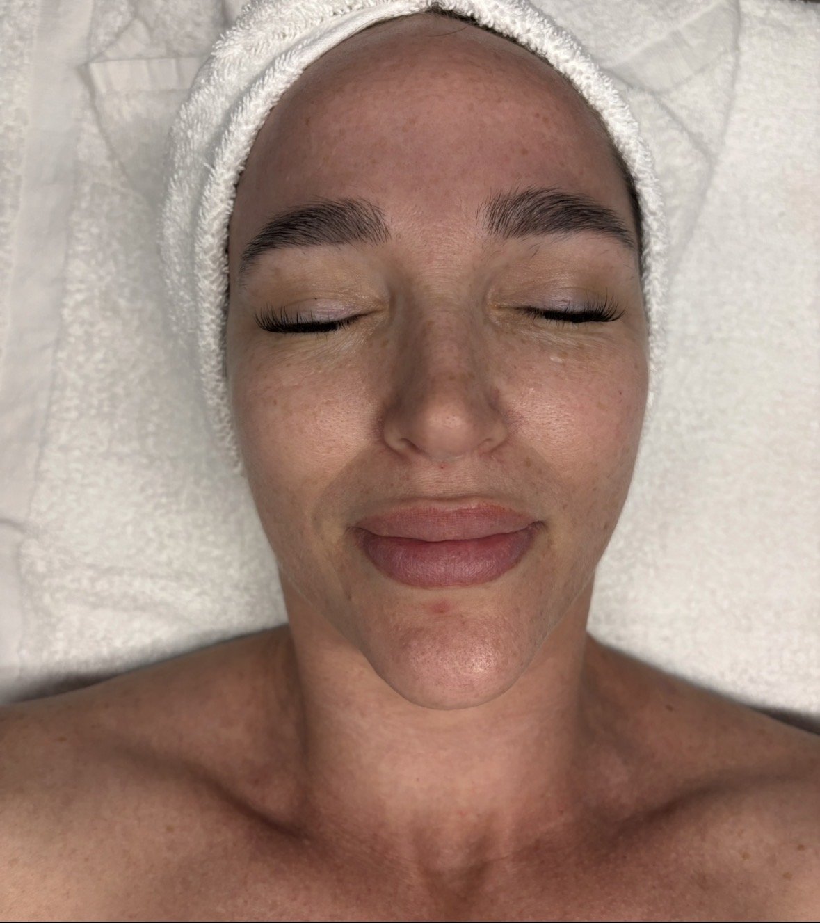 Before waxing treatment